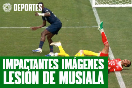 IMPACTANTES IMÁGENES DE LA LESIÓN DE MUSIALA EN EL BAYERN VS PSG